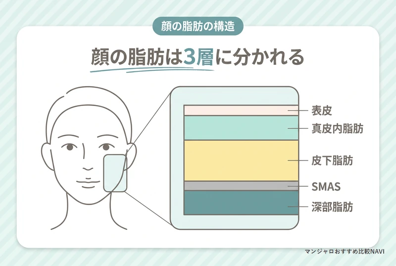顔の脂肪が真皮内脂肪 皮下脂肪 深部脂肪の3層に分かれることを示した断面図
